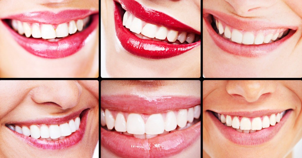 The differences between Veneers and Dental Bonding: choosing what’s best for you.